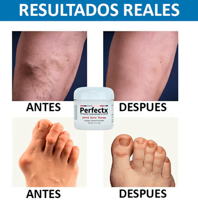 Perfectx™ Terapia para Articulaciones y Músculos - ENVÍO GRATIS